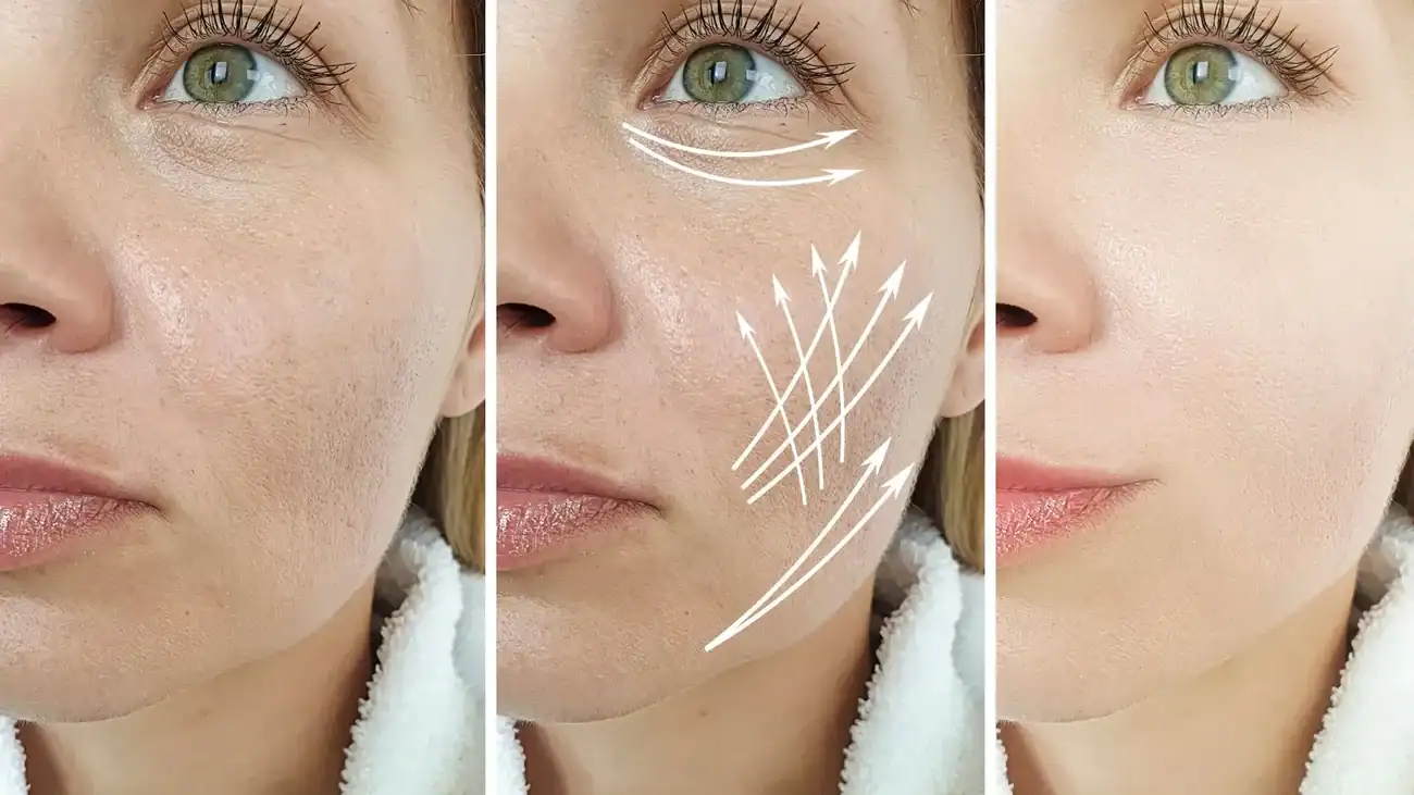 Can One Treatment Really Tackle More Than One Skin Concern Solihull?