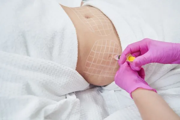image of fat dissolving injections on love handles to help combat weight gain Solihull