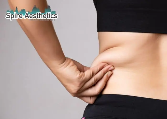 Image of woman pinching fat on their hips Solihull. Fat Freezing treatment