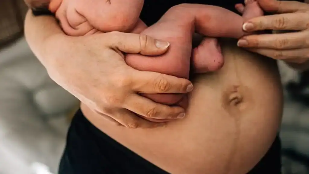 Why Is My Stomach Still Big After Pregnancy Solihull?